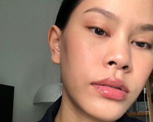 blackheads nose treatment