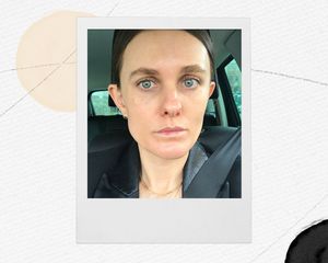 A portrait of Sacha Strebe, after getting eye fillers.