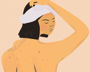 Illustration of bacne