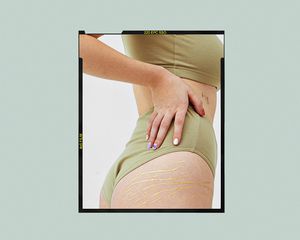 Woman pulls at her shorts