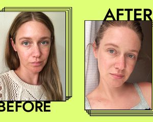 Dr. Jart+ Ceramidin Cream Results on Nicole Kliest