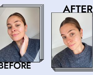 iS Clinical Cleansing Complex Results on Emily Algar