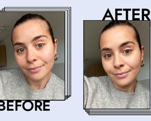 Laneige Water Bank Moisture Cream Results on Emily Algar
