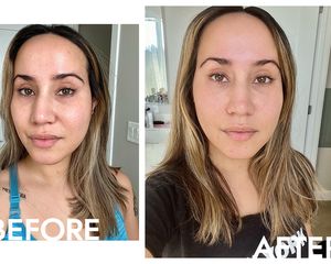 Ourself HA Replenishing + Serum before and after