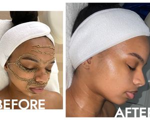 Qi Beauty Facial before and after