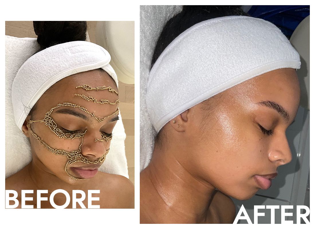 Qi Beauty Facial before and after
