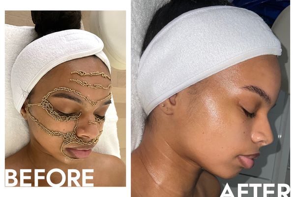 Qi Beauty Facial before and after