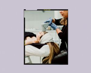 Face Spider Vein Treatments